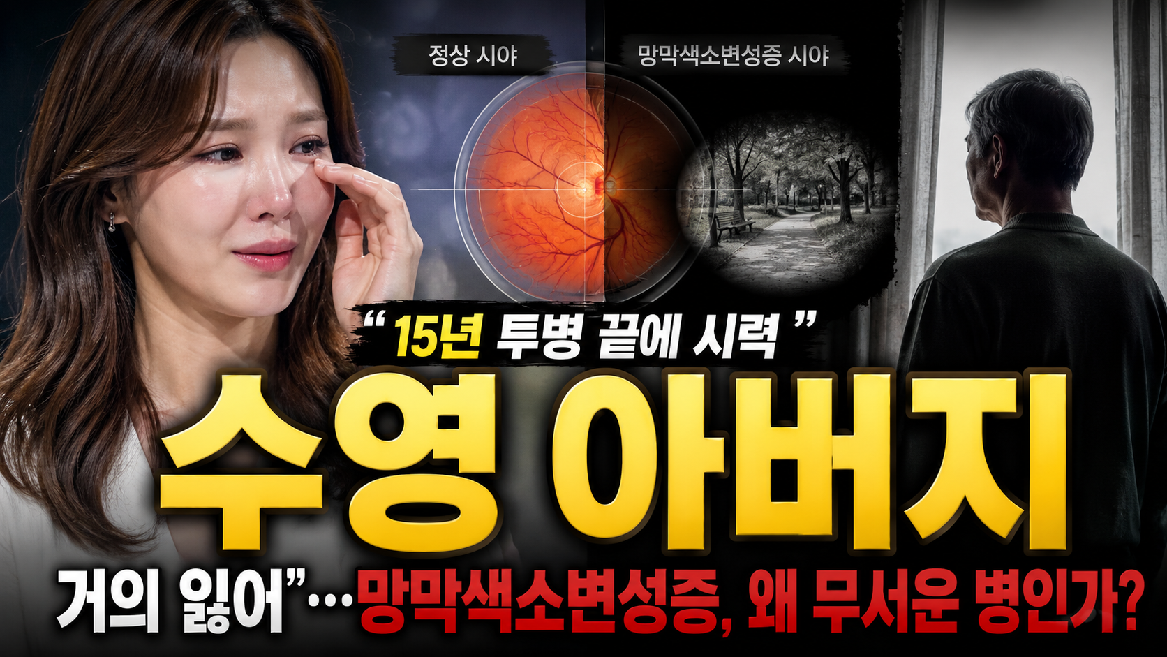 수영 아버지 “15년 투병 끝에 시력 거의 잃어”…망막색소변성증, 왜